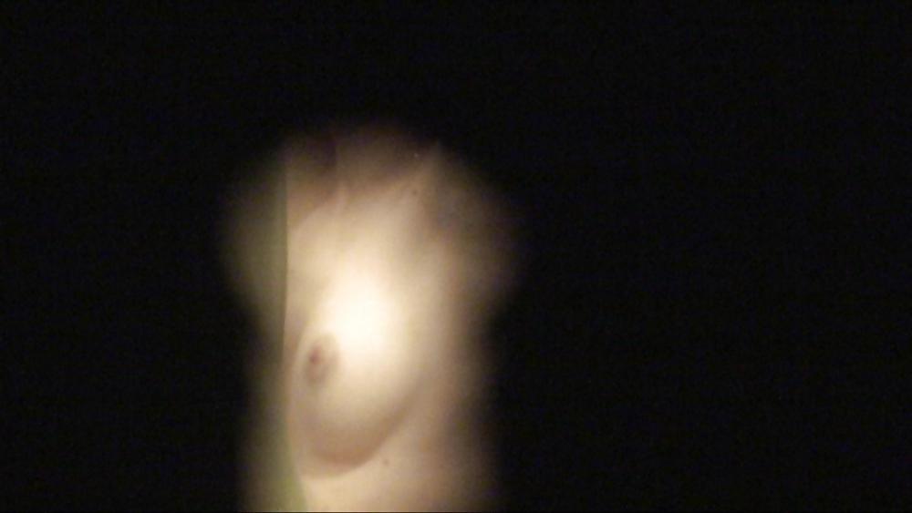 12P Keyhole