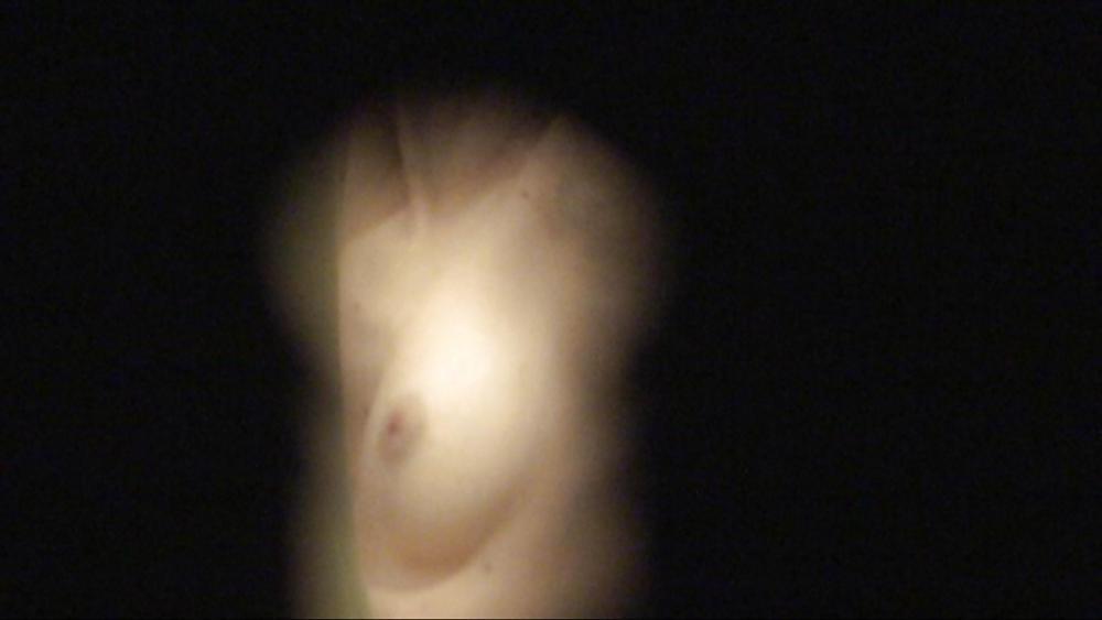 12P Keyhole