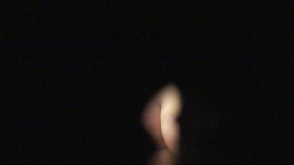 12P Keyhole