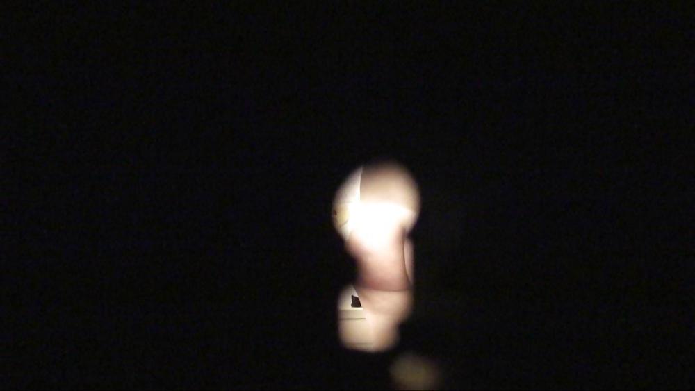 12P Keyhole