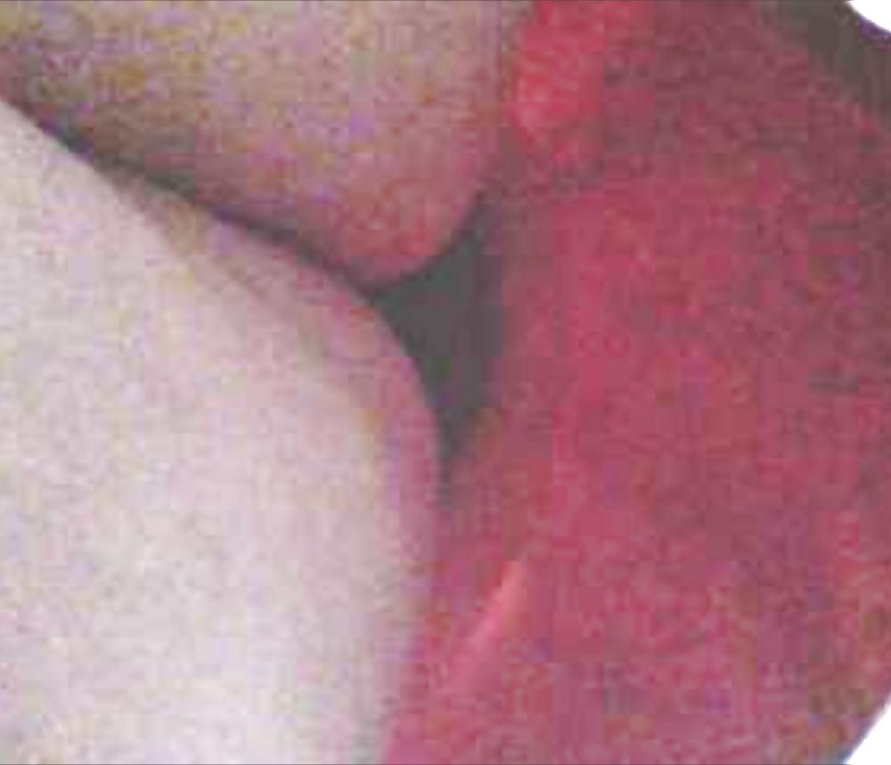 13P More upskirts