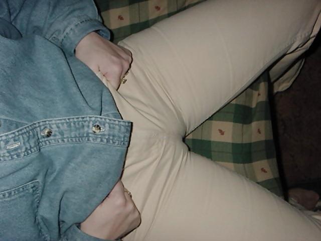 15P Cameltoes