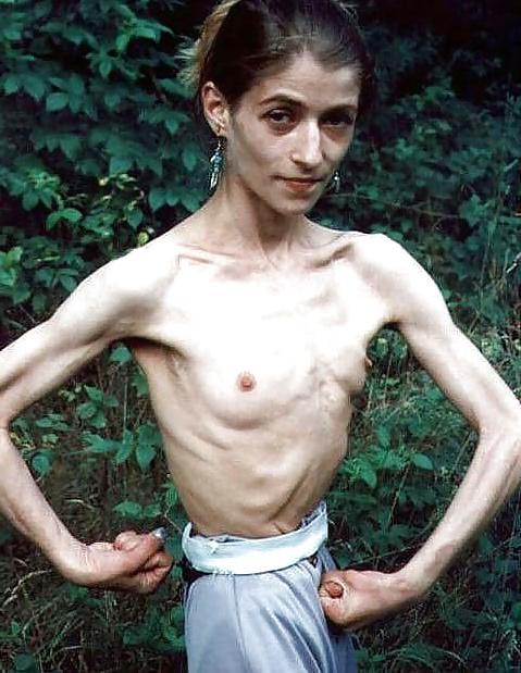 19P Skinny Girls