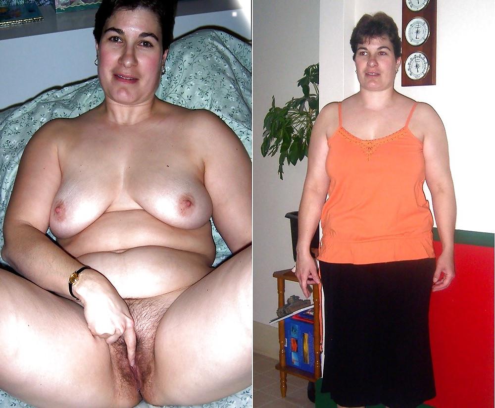 20P Dressed & Naked Set 63