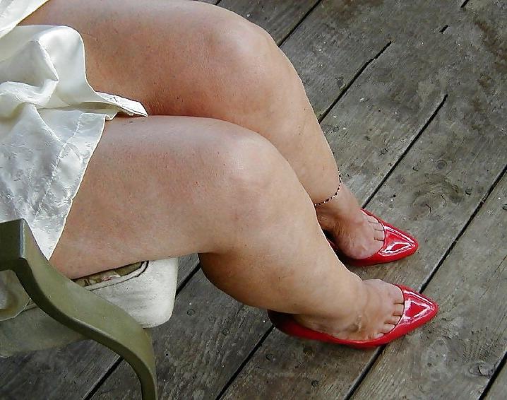 4P Toe Cleavage (TC)