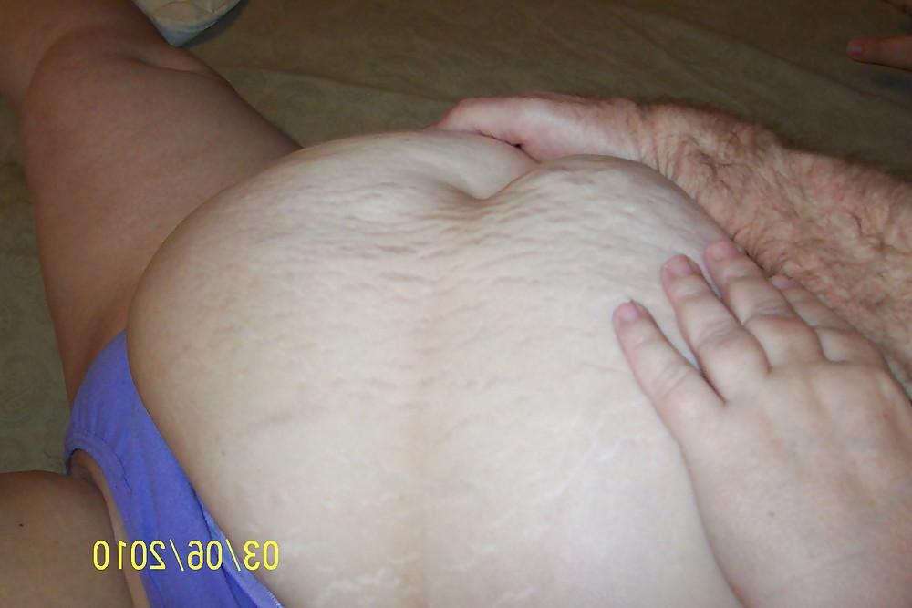 16P Belly shots