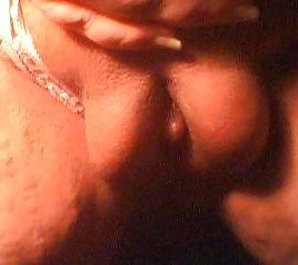 19P Pumped and puffy 