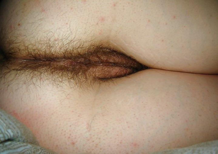 14P Hairy Ass Women-Cool? Or Not? Perverse?