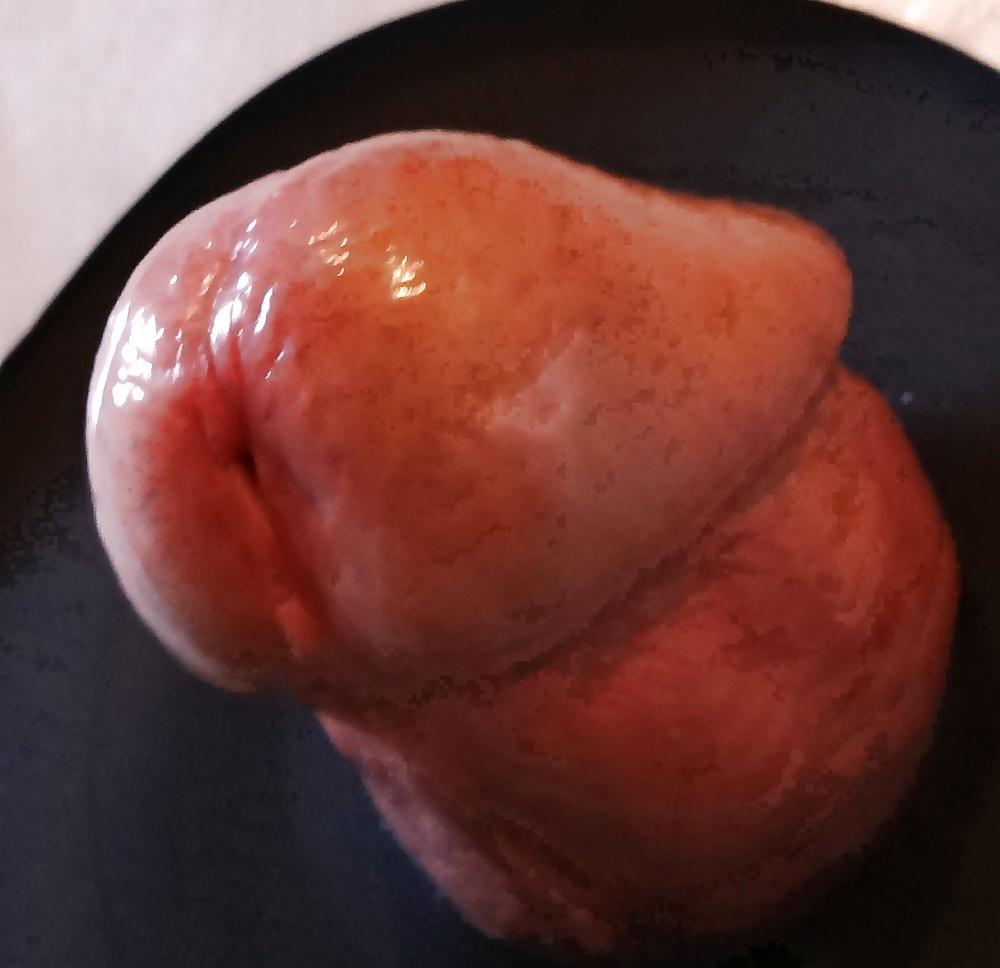 5P My head close-up