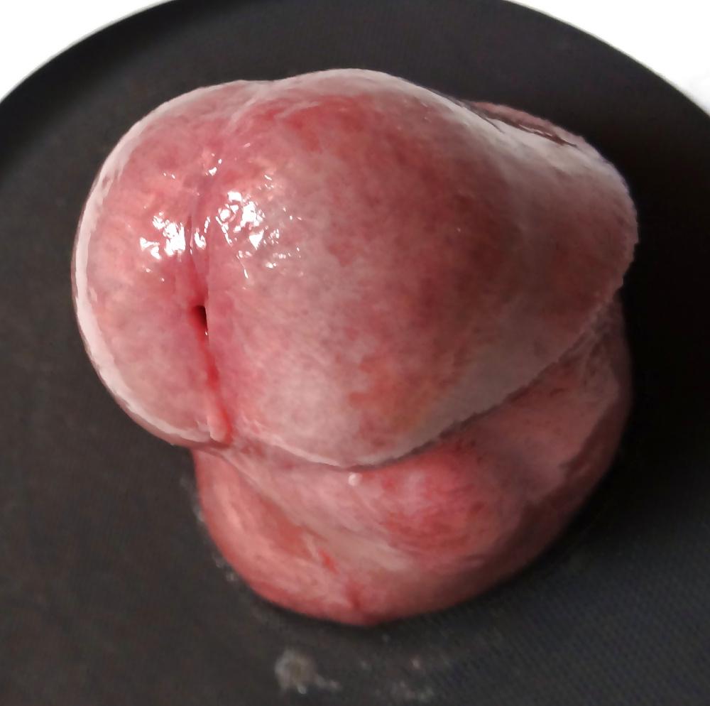 5P My head close-up