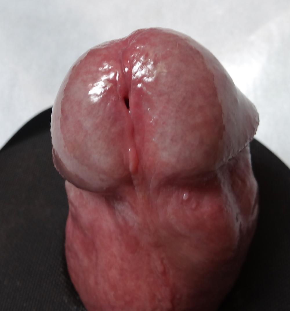 5P My head close-up