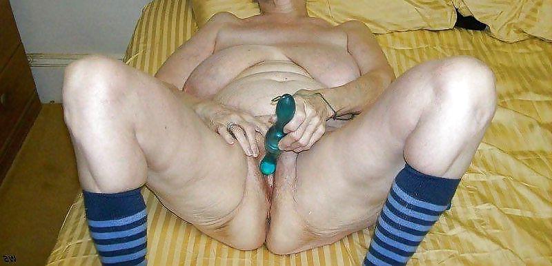 25P The show case of the open legs