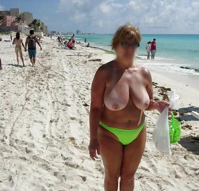 15P Cameltoes