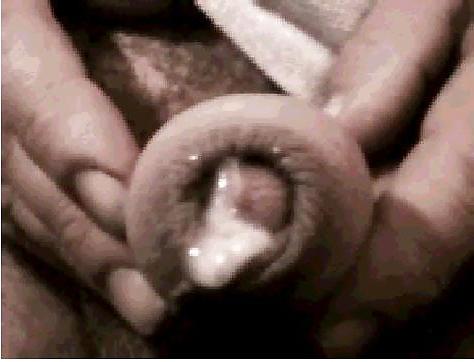 8P My penis