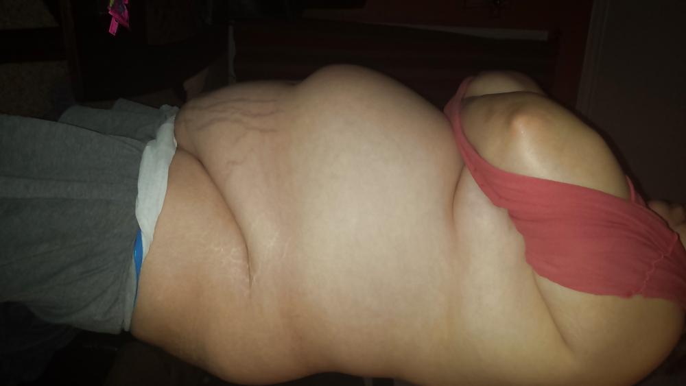 17P Big belly