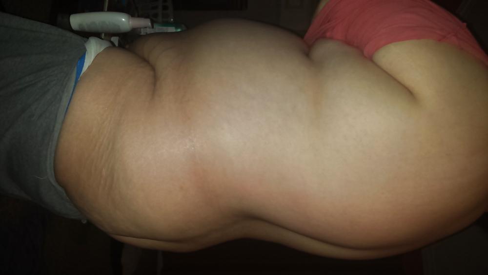 17P Big belly