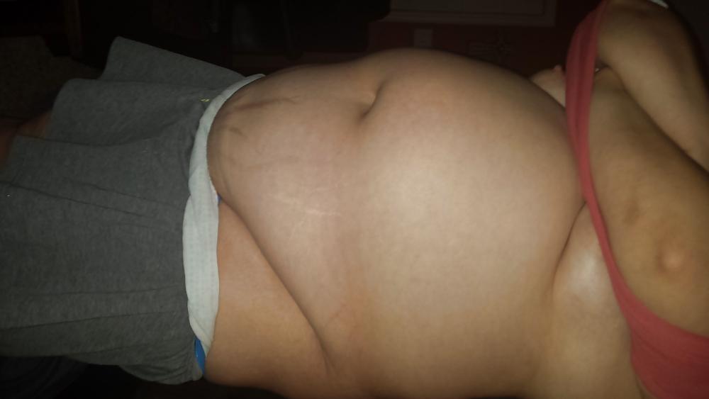 17P Big belly