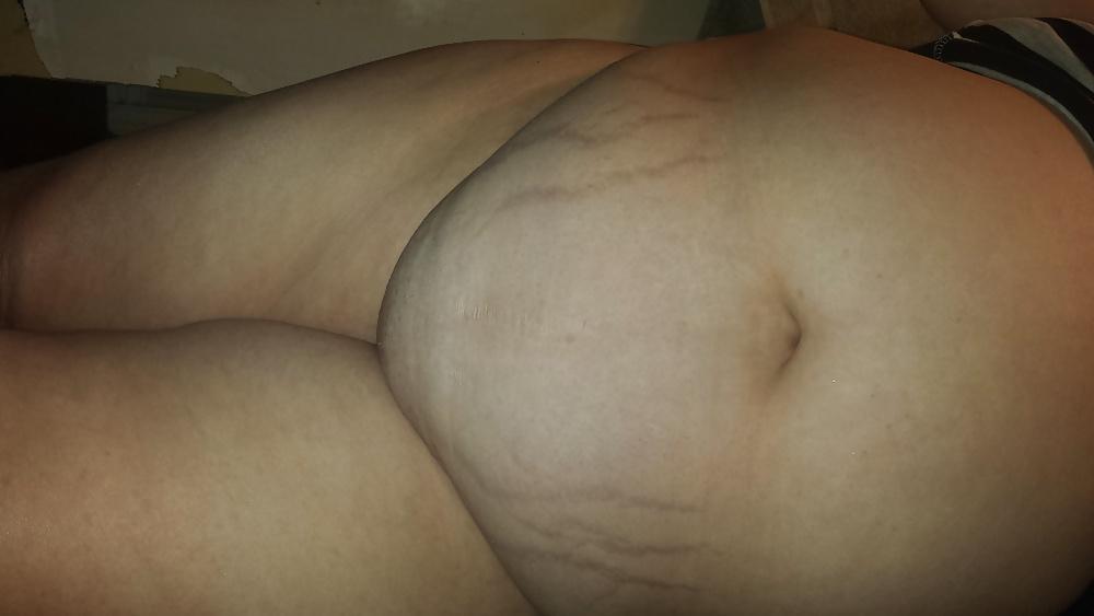 17P Big belly