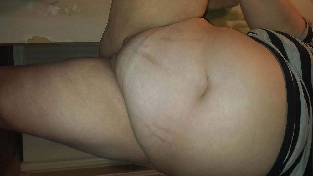 17P Big belly