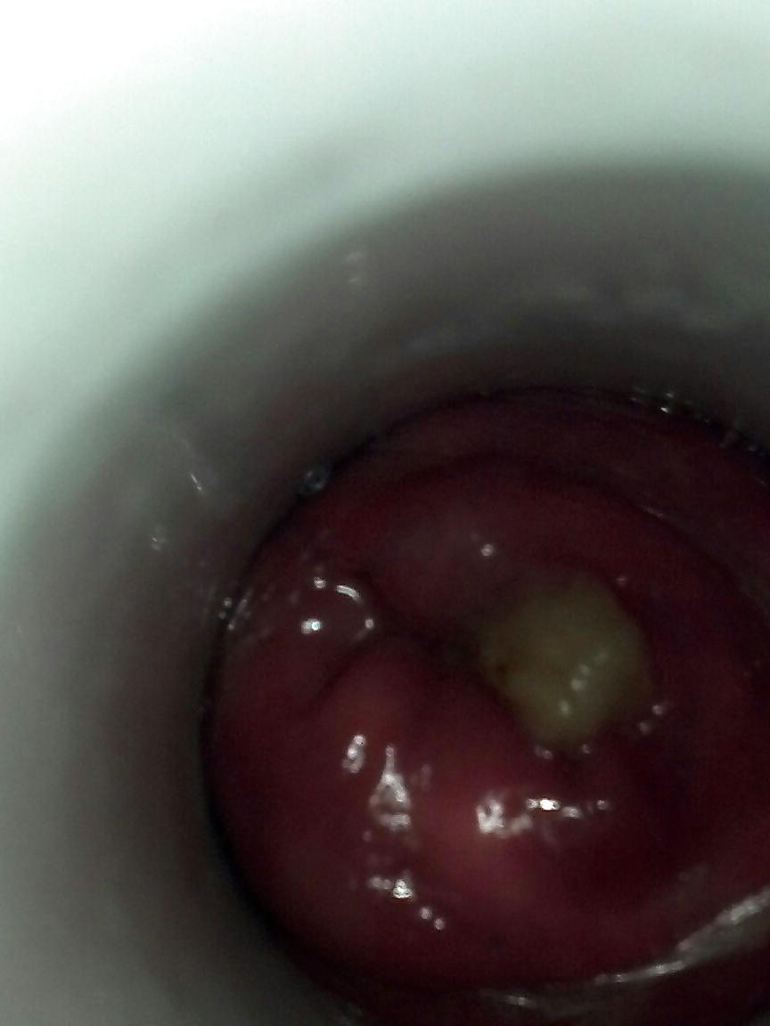 7P Gaped asshole