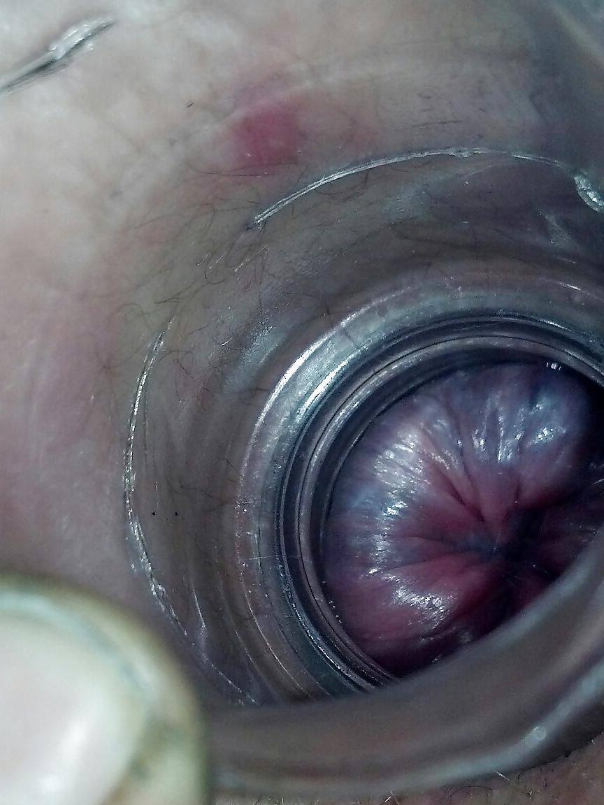 7P Gaped asshole