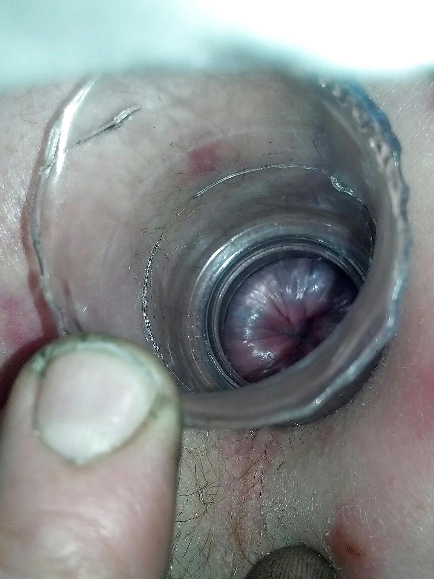 7P Gaped asshole