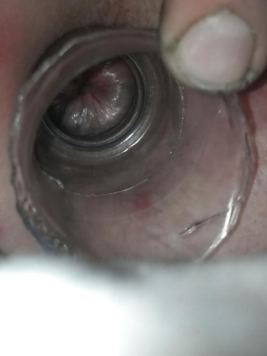 7P Gaped asshole
