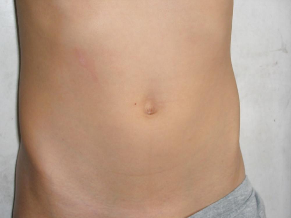 13P Cute Belly's