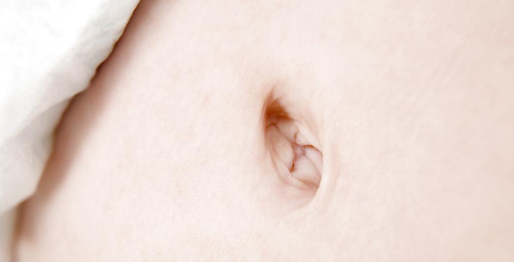 13P Cute Belly's