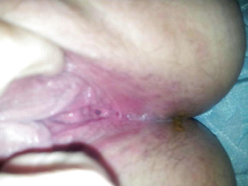 17P Some ugly fat girl