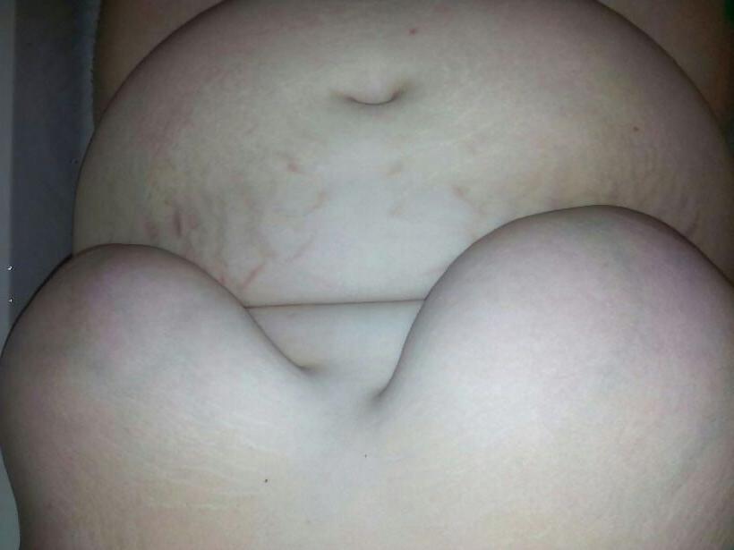 17P Some ugly fat girl