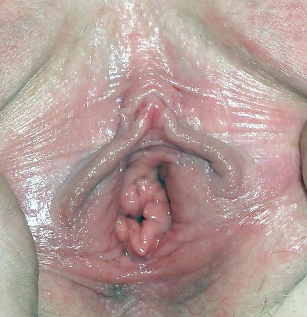 10P Pussy