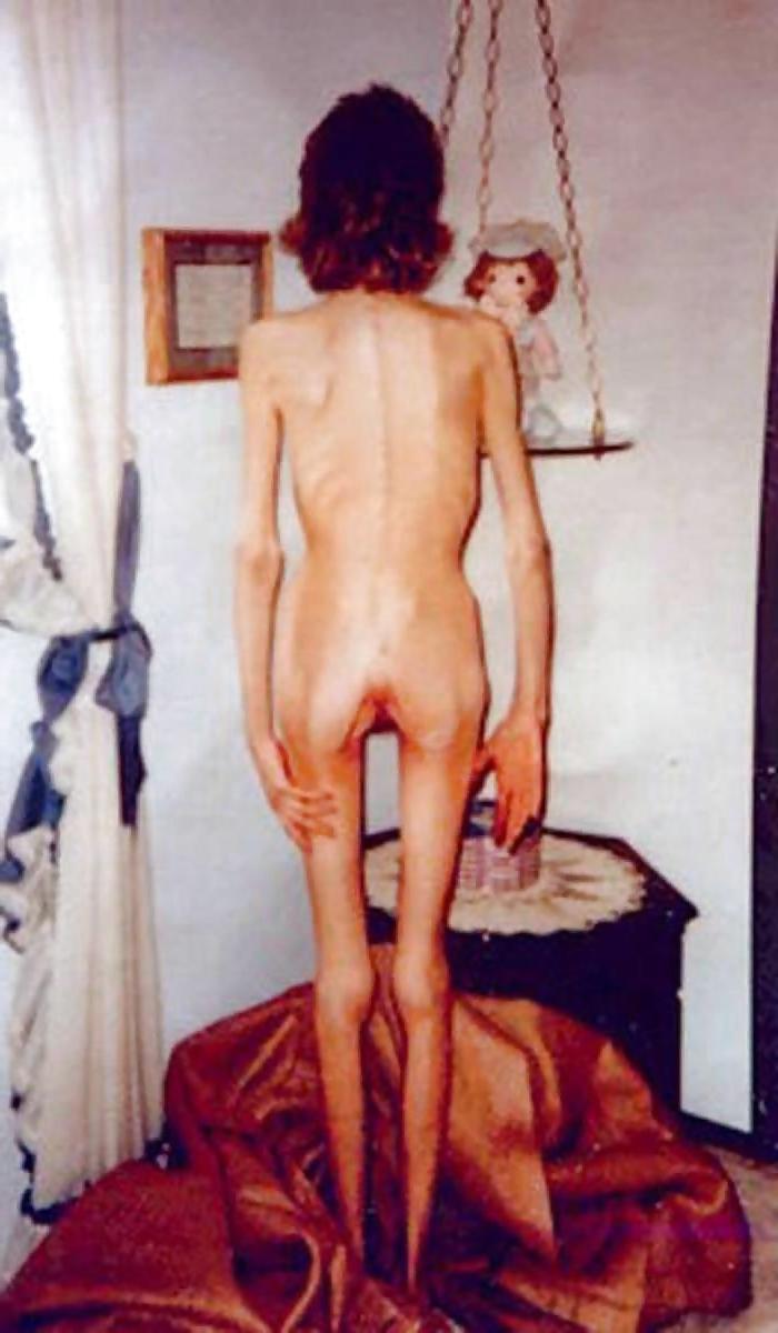 25P Snahbrandy's Skinny Girls 2