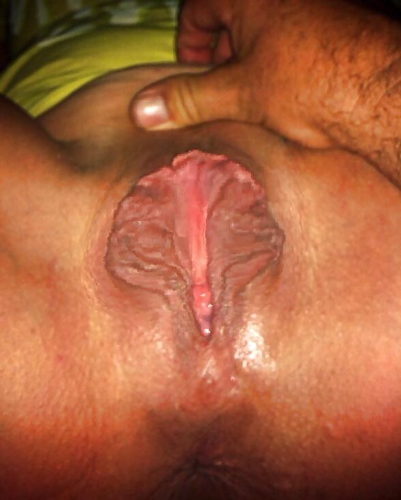 7P HuGE LiPS