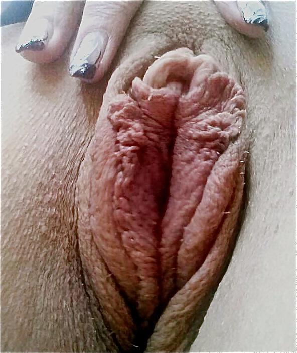 7P HuGE LiPS