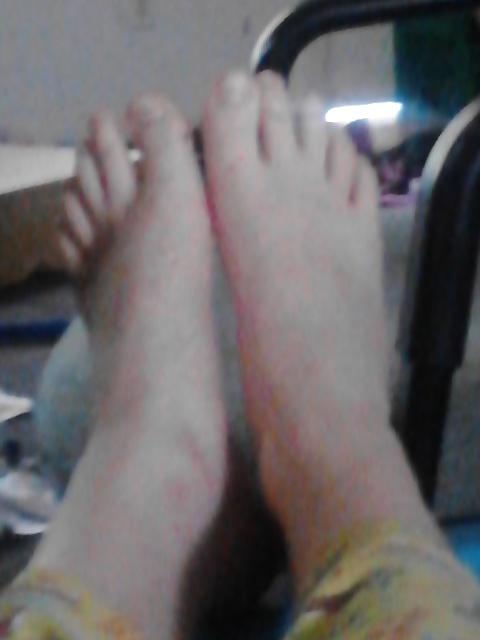 25P Random Feet