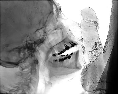 19P Sex under mri or xray