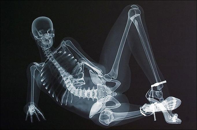 19P Sex under mri or xray