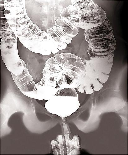19P Sex under mri or xray