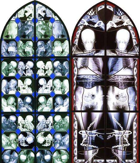 19P Sex under mri or xray