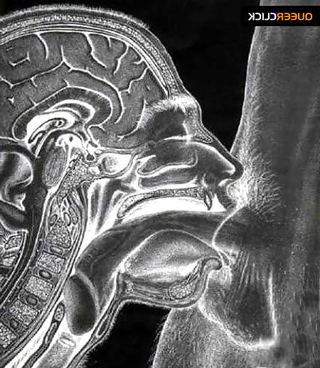 19P Sex under mri or xray