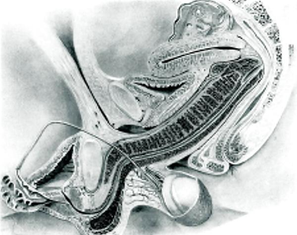 19P Sex under mri or xray
