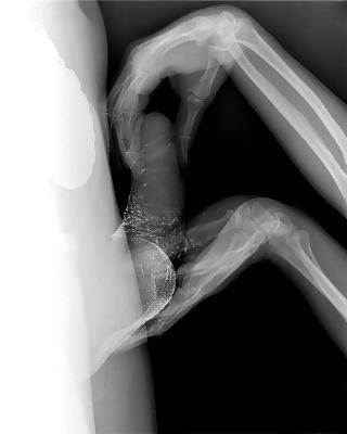 19P Sex under mri or xray