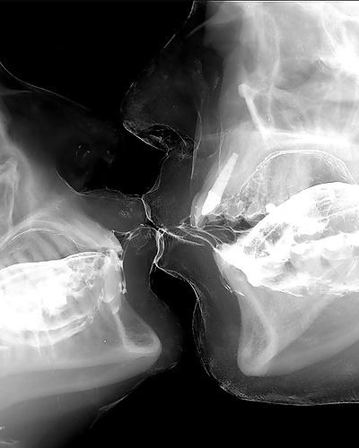 19P Sex under mri or xray