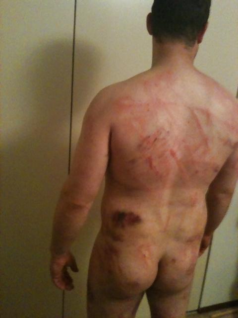 15P Flogging, Caning Marks from Mistress.  Bondage