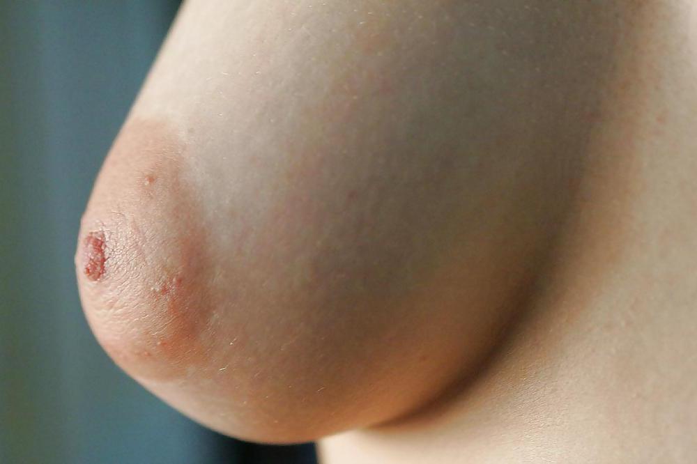 11P Closeups
