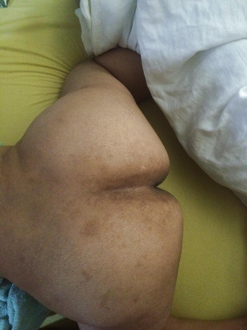 9P Dominican mature