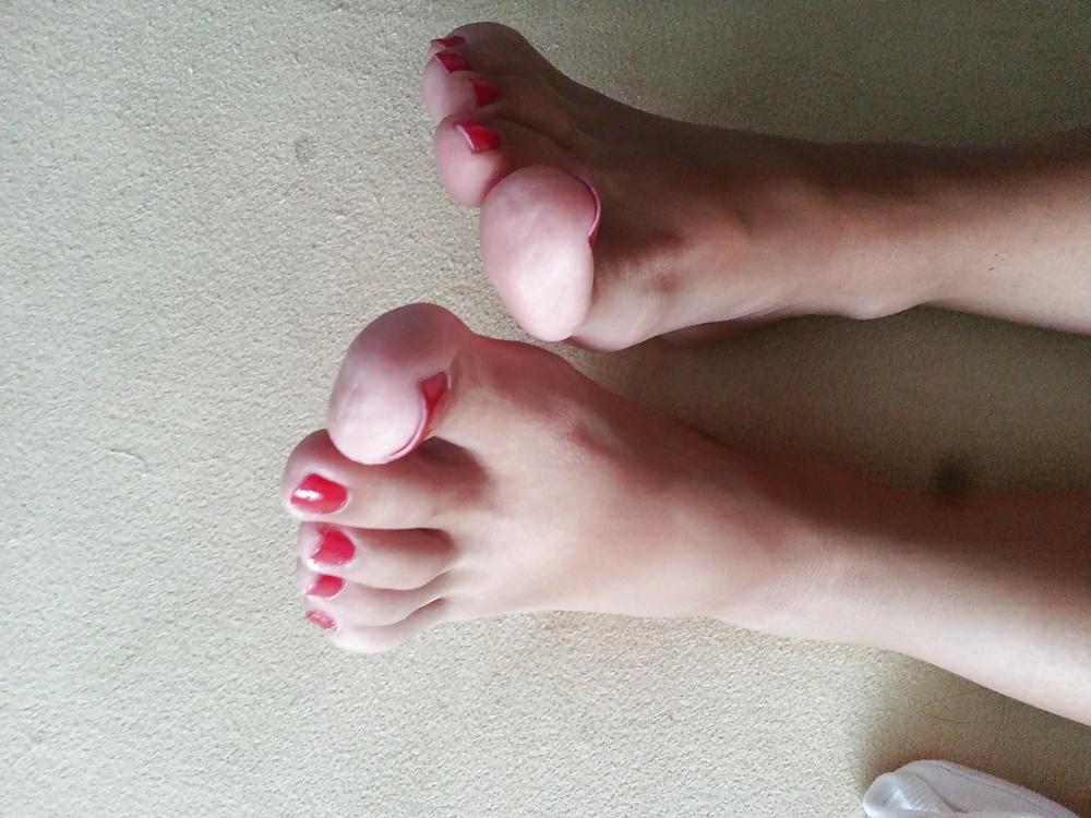 25P Toes Andrea