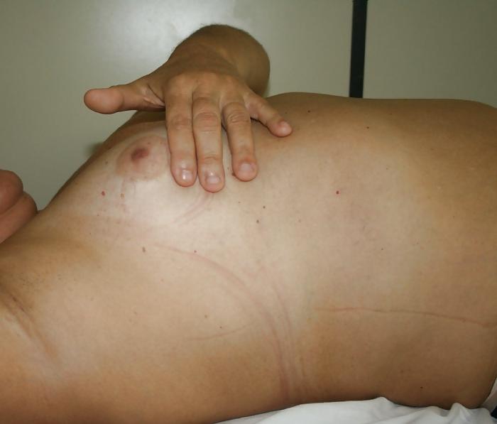 25P Women over 50 yo breasts exams prevention