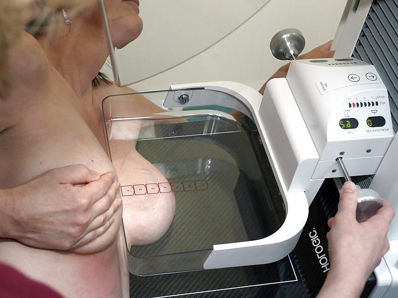 25P Women over 50 yo breasts exams prevention